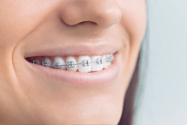 Best Full Mouth Reconstruction  in El Dorado, KS